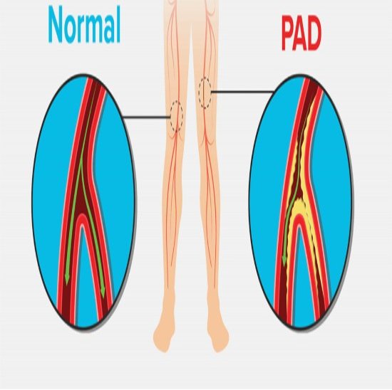 Interventional Radiology Equipment